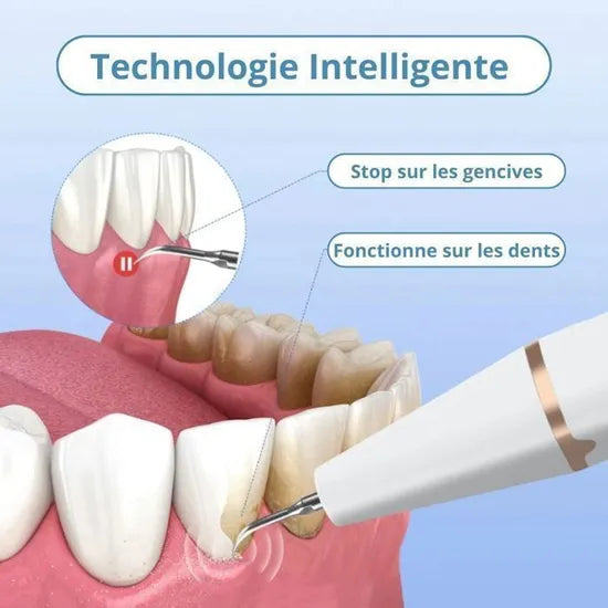 Détarrreur Electrique
