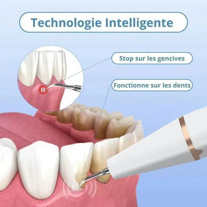 Détarrreur Electrique